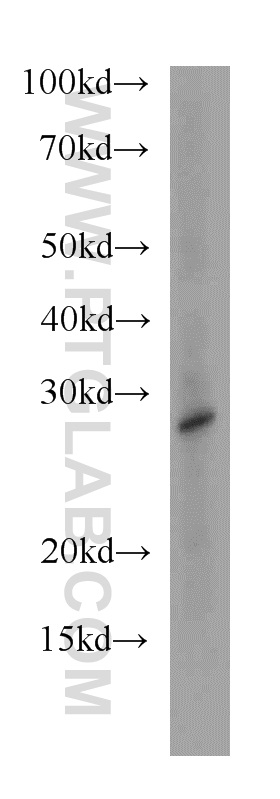 HDHD3 Polyclonal antibody