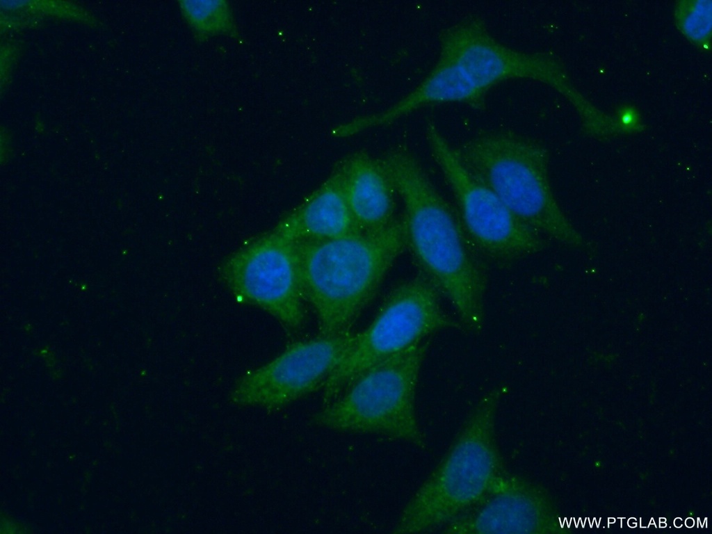 SGSM3 Polyclonal antibody