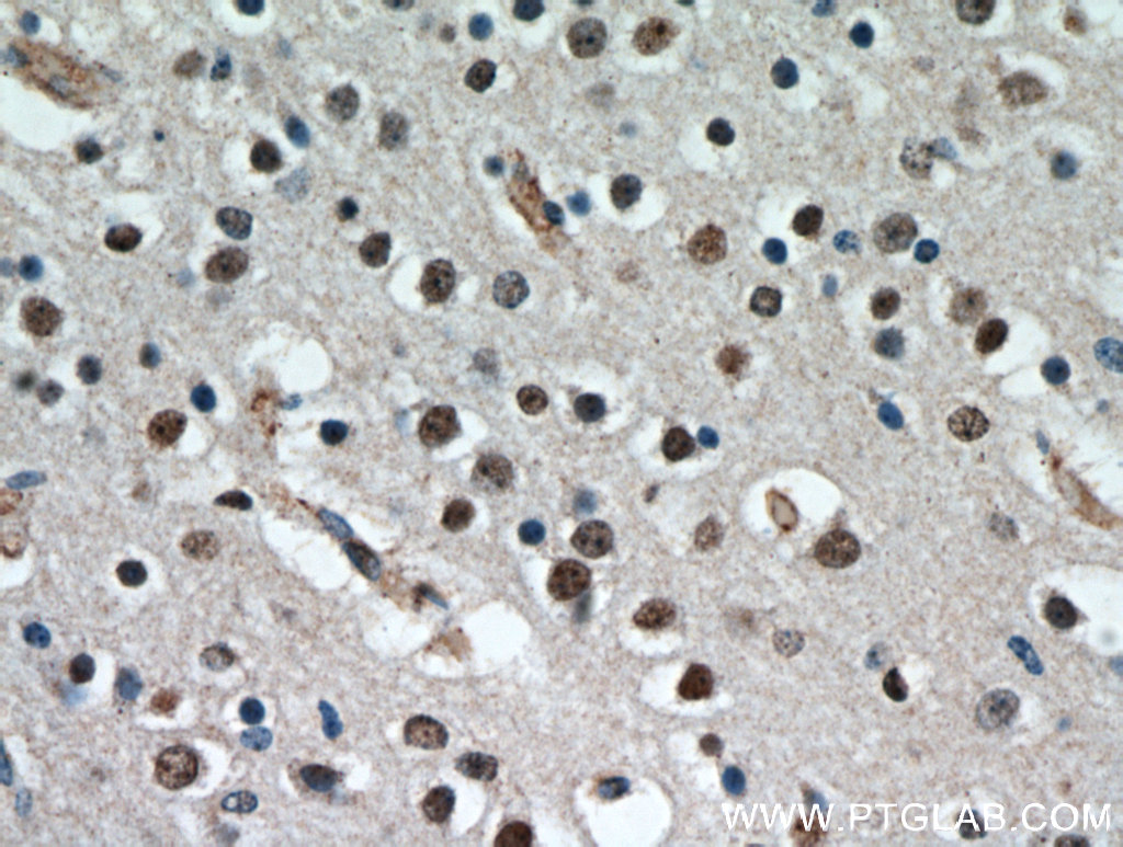 CCDC42 Polyclonal antibody
