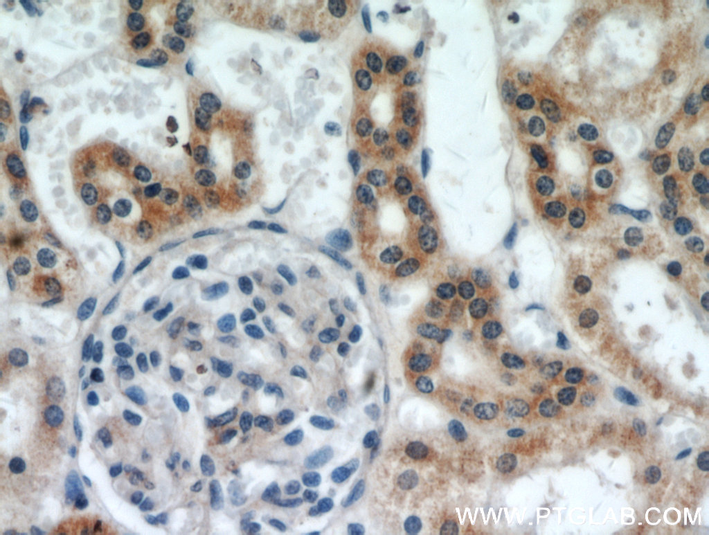 SLC38A4 Polyclonal antibody
