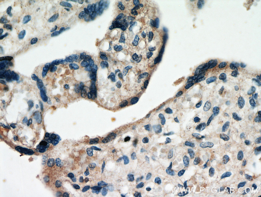 FAM76A Polyclonal antibody