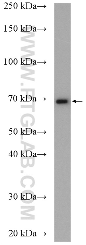 CALCR Polyclonal antibody