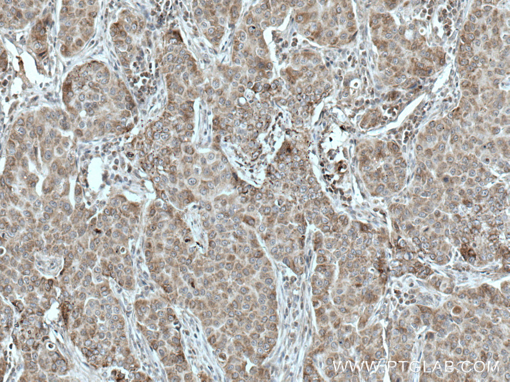 TTC19 Polyclonal antibody