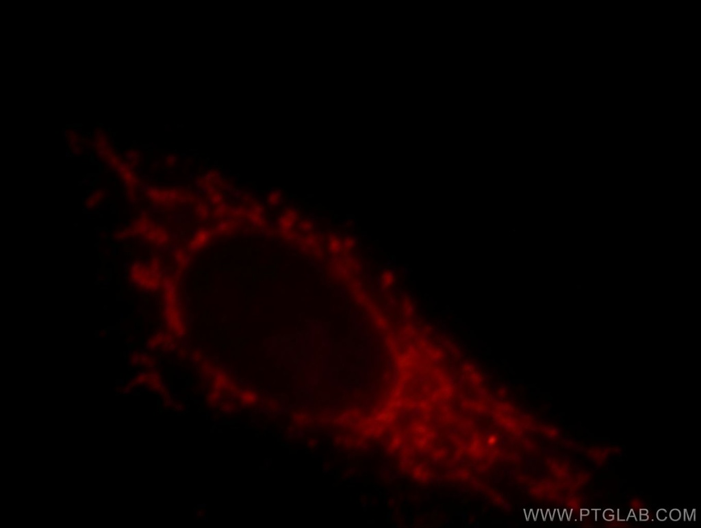LZTS1 Polyclonal antibody