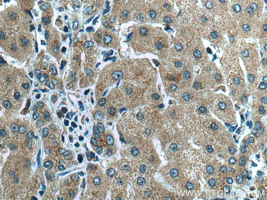 AIFM2/ FSP1 Polyclonal antibody