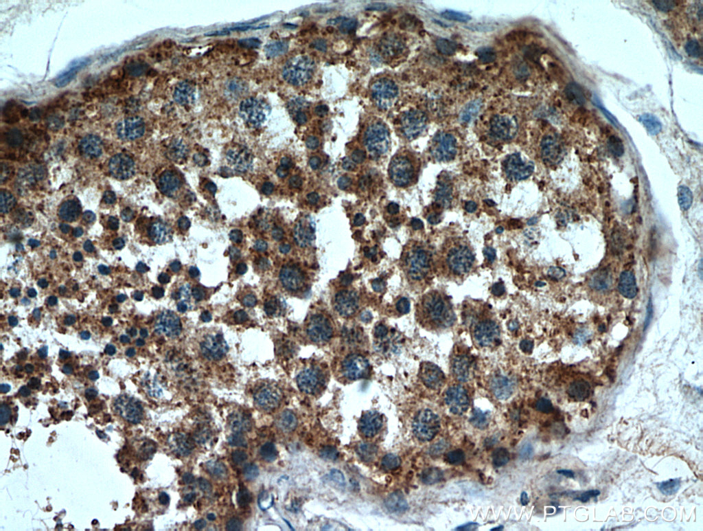 SDF2L1 Polyclonal antibody