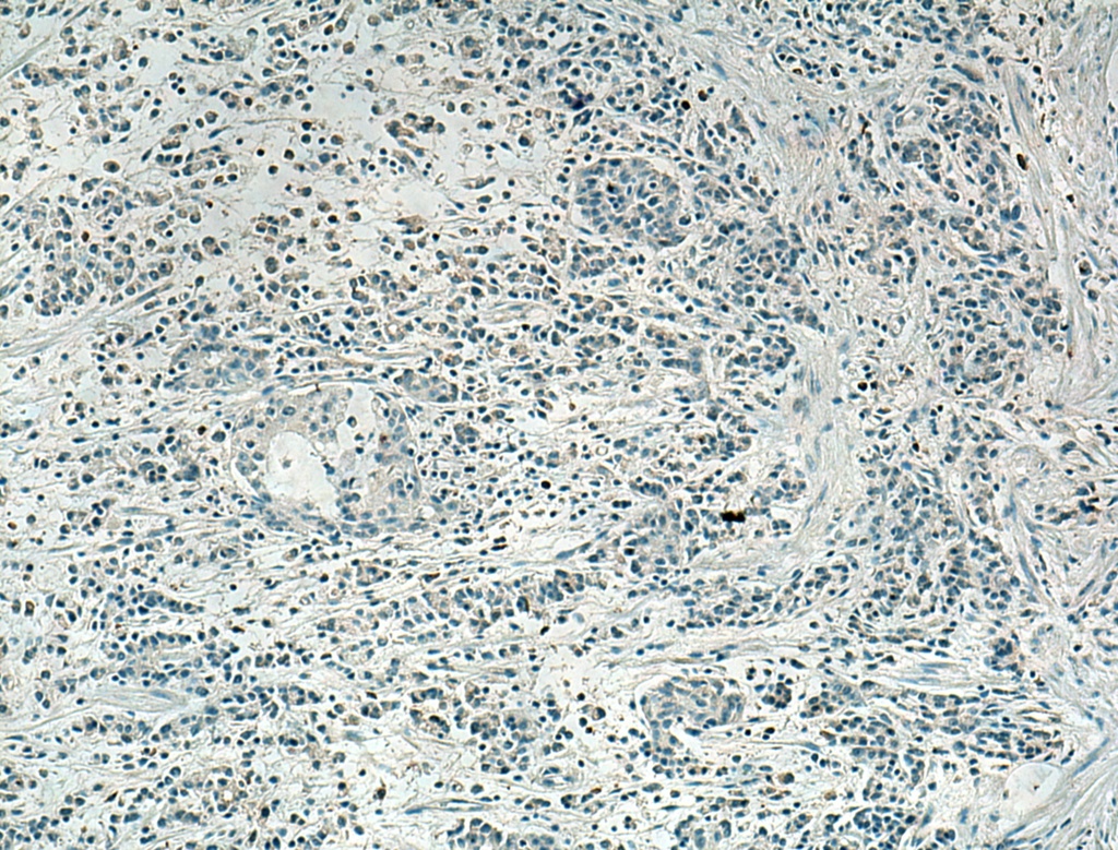 SLC16A4 Polyclonal antibody