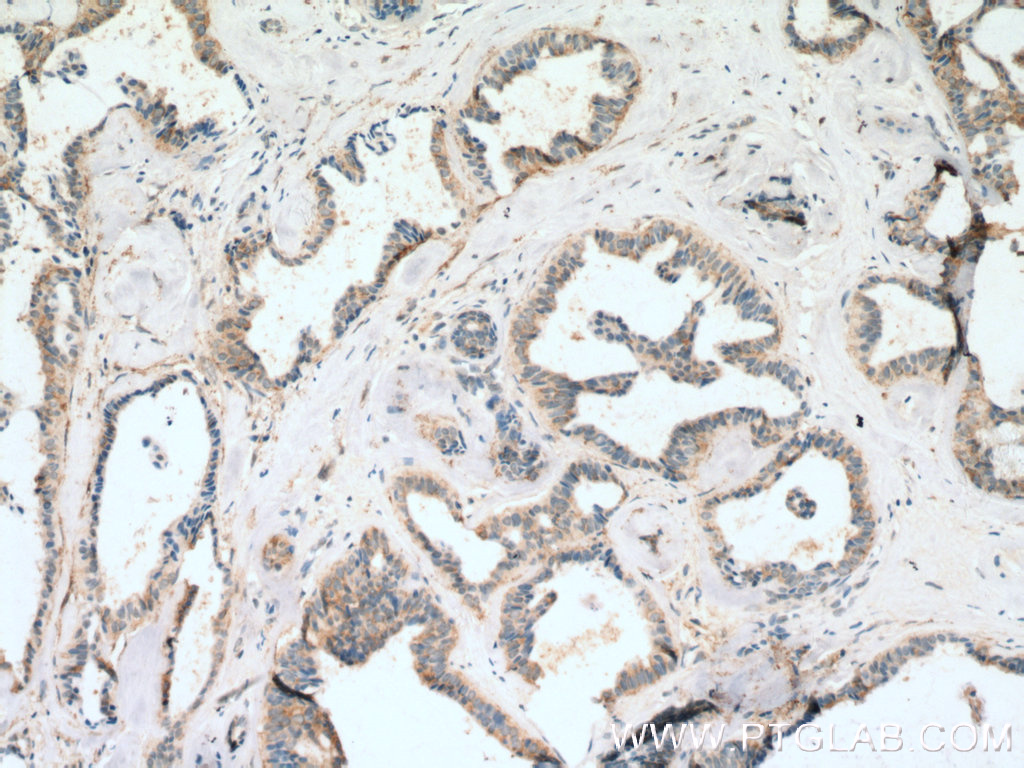 FBXL15 Polyclonal antibody