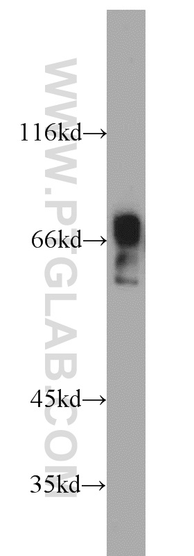 ZNF496 Polyclonal antibody
