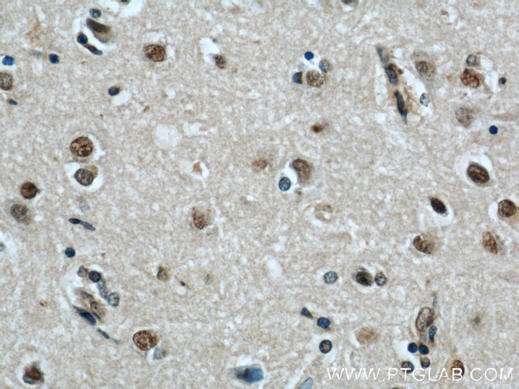FAM71E2 Polyclonal antibody