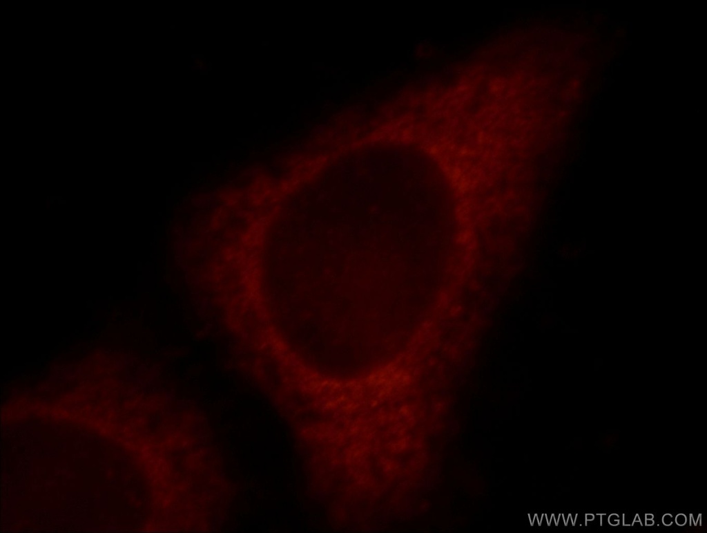 FGD5 Polyclonal antibody