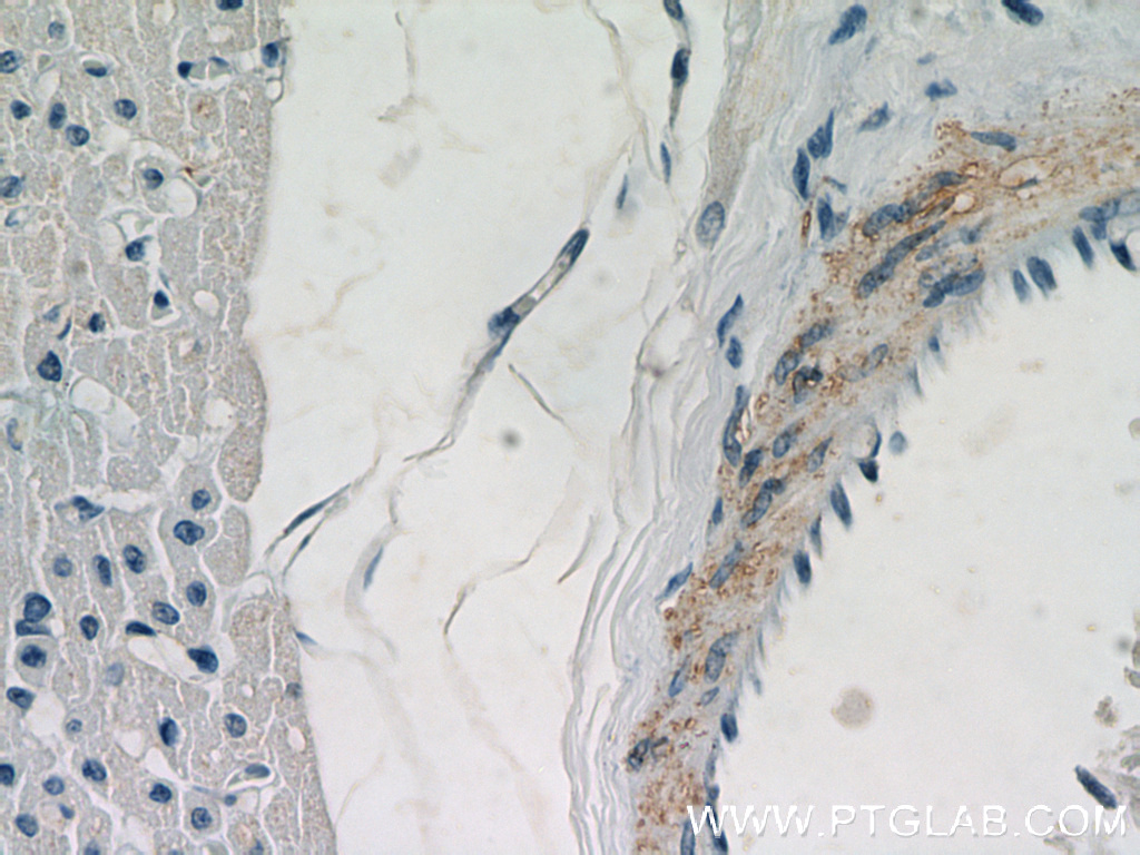 WDR37 Polyclonal antibody