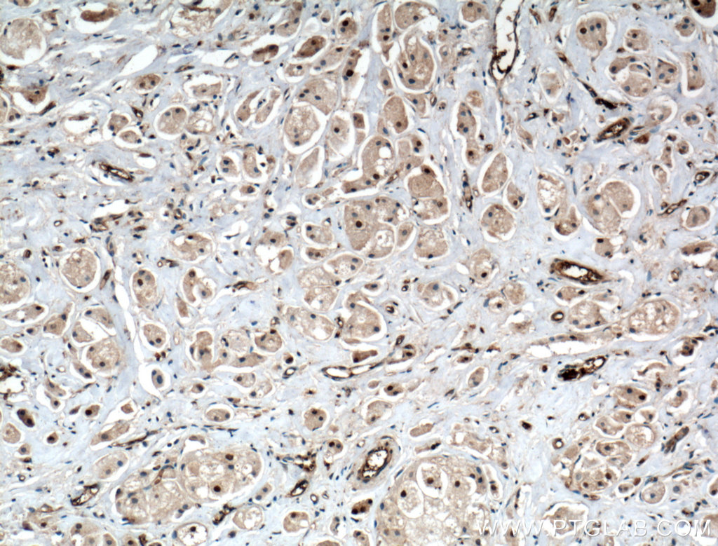 ITCH Polyclonal antibody