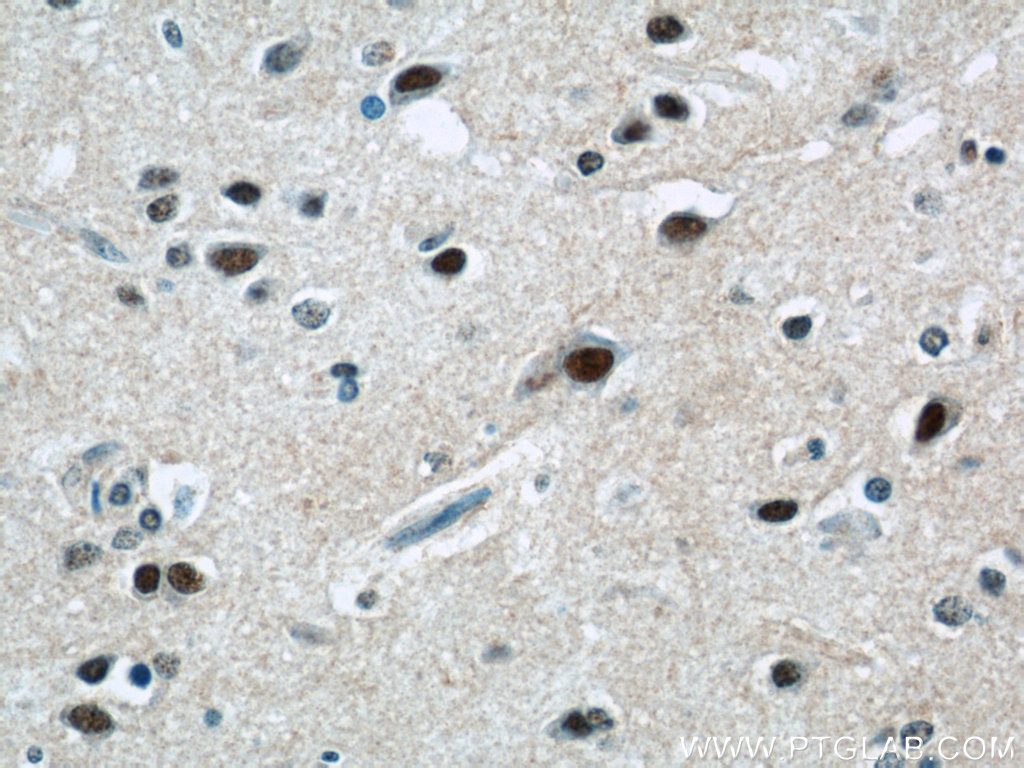 ZNF597 Polyclonal antibody