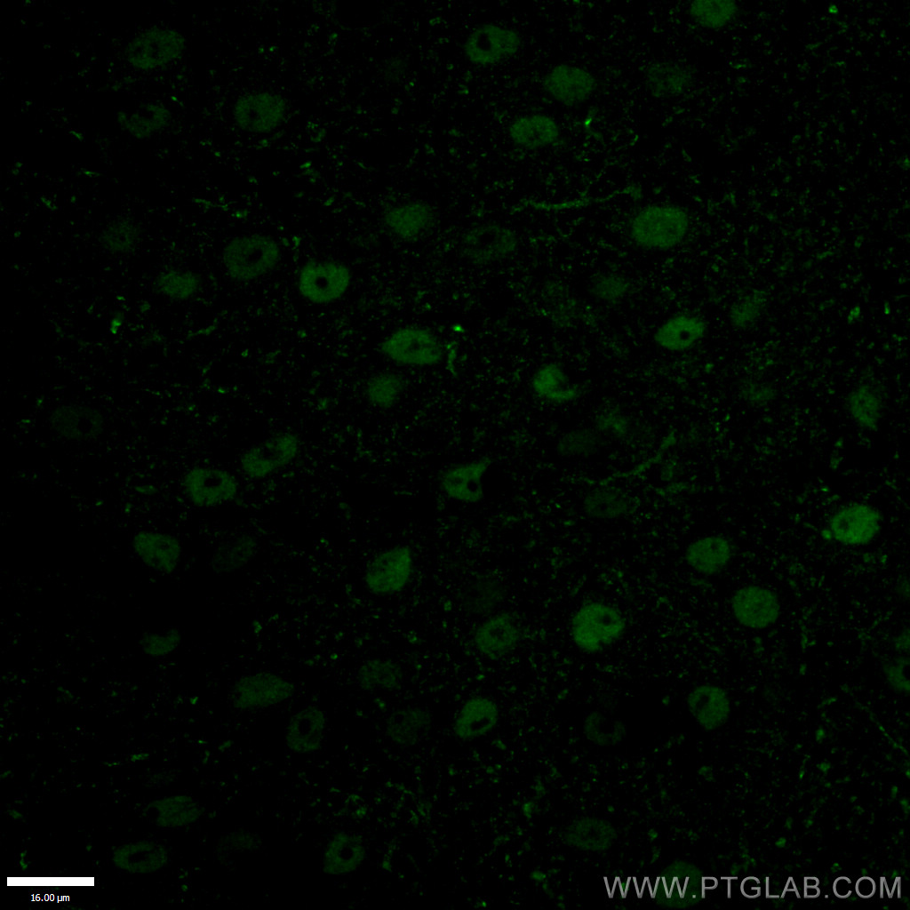 TBR1 Polyclonal antibody
