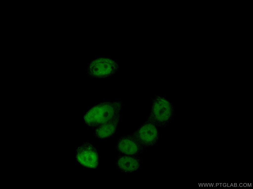 PHIP Polyclonal antibody