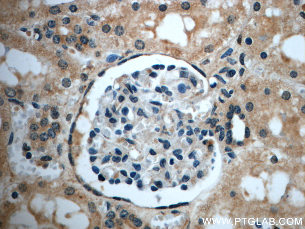 ZC3HAV1L Polyclonal antibody