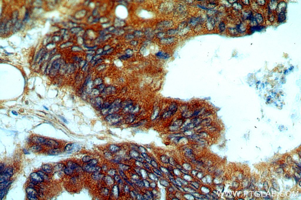 PYCR1 Polyclonal antibody