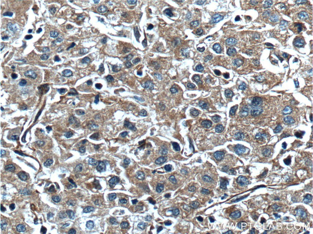 F5 Polyclonal antibody