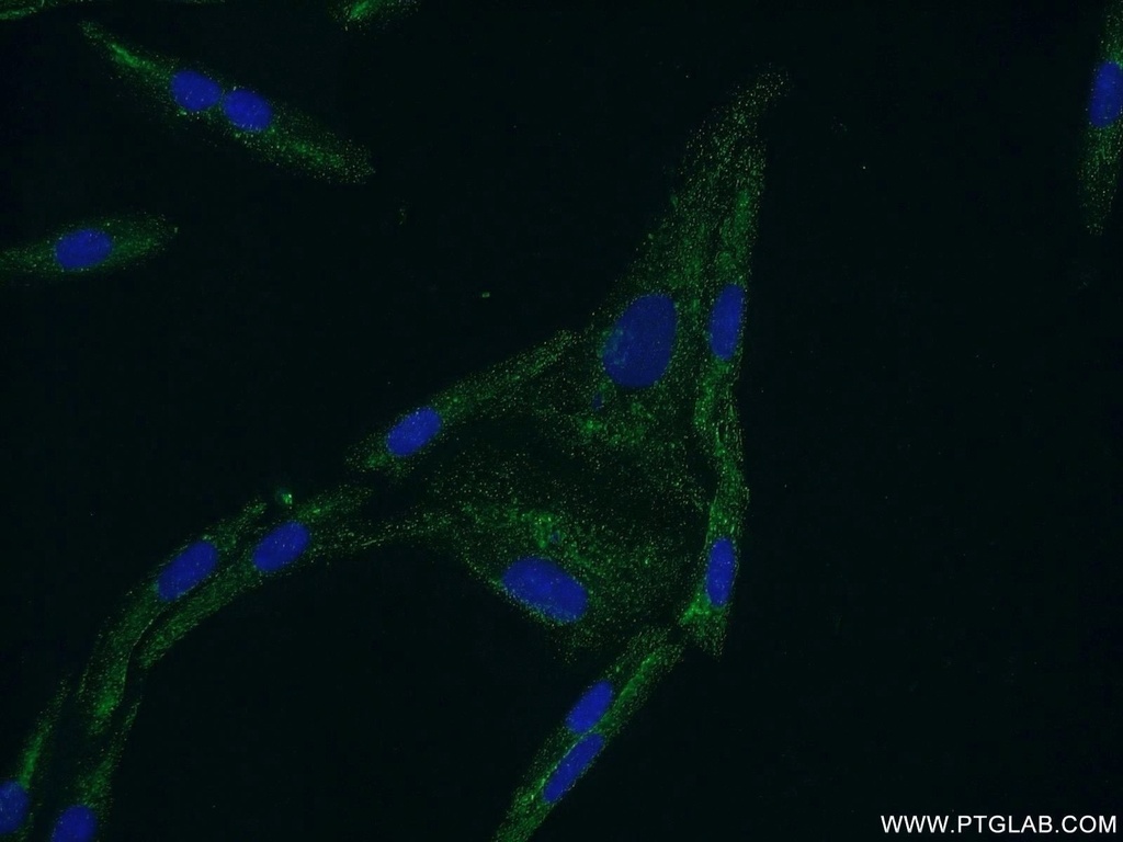 CYP11B2 Polyclonal antibody