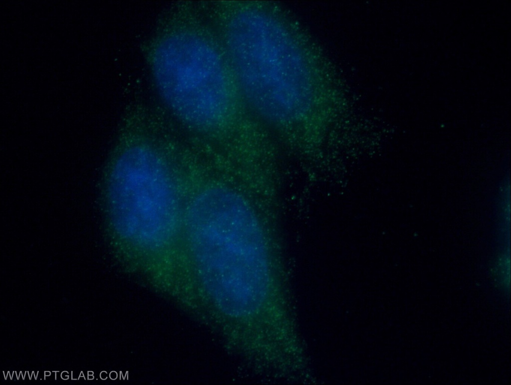 Raptor Polyclonal antibody
