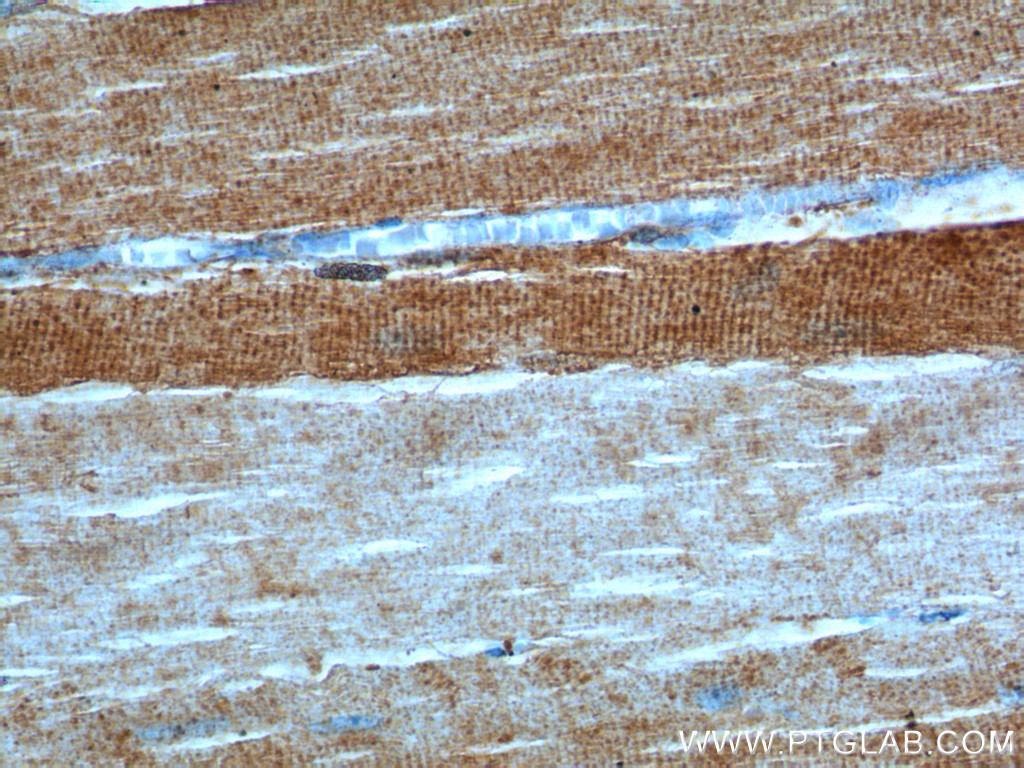 ULK1 Polyclonal antibody