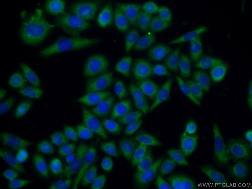 TMEM106B Polyclonal antibody