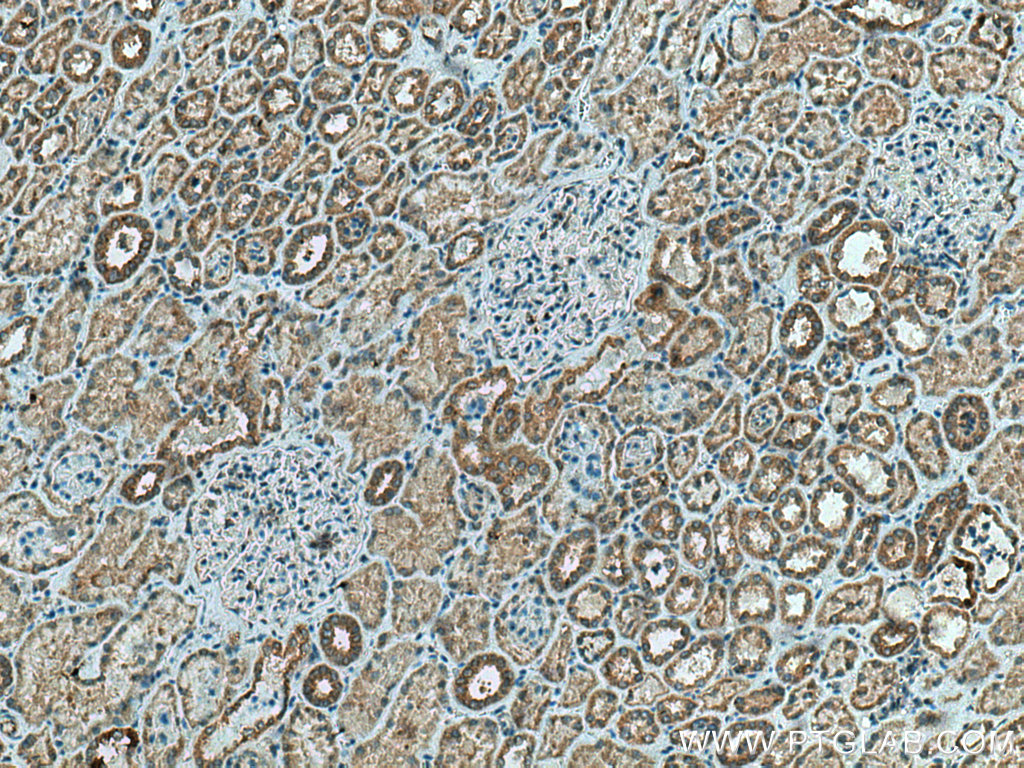 TMEM61 Polyclonal antibody