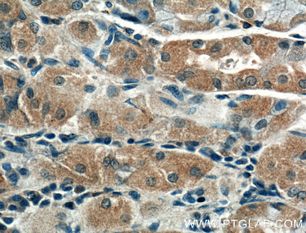 CRYBB3 Polyclonal antibody