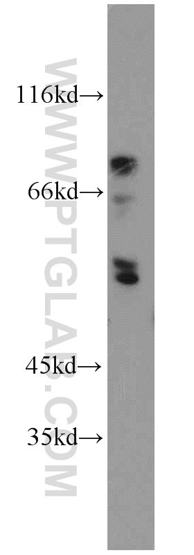 ENTPD8 Polyclonal antibody