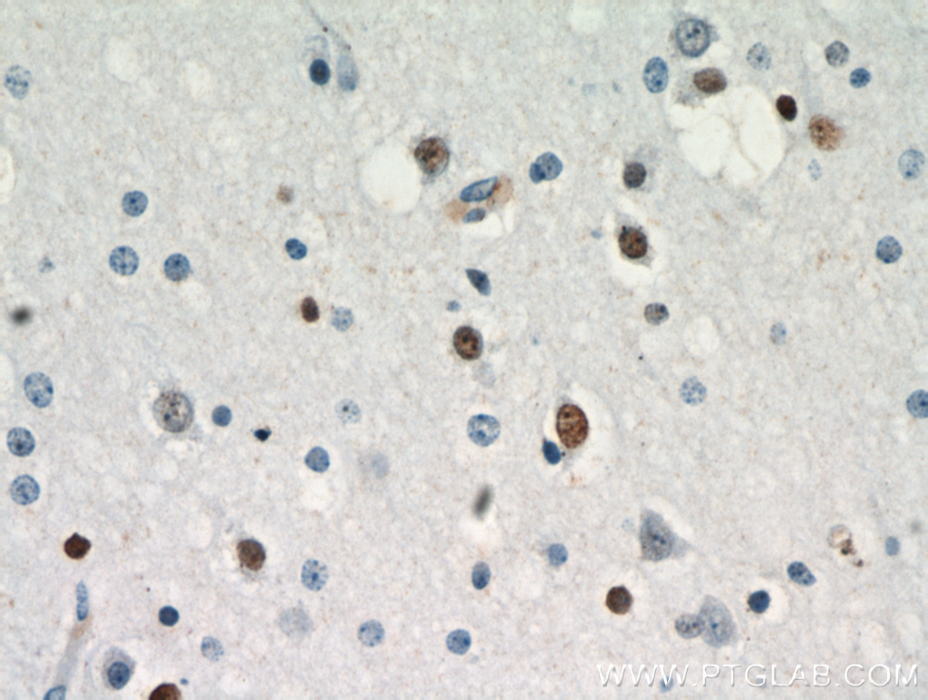 ZNF488 Polyclonal antibody