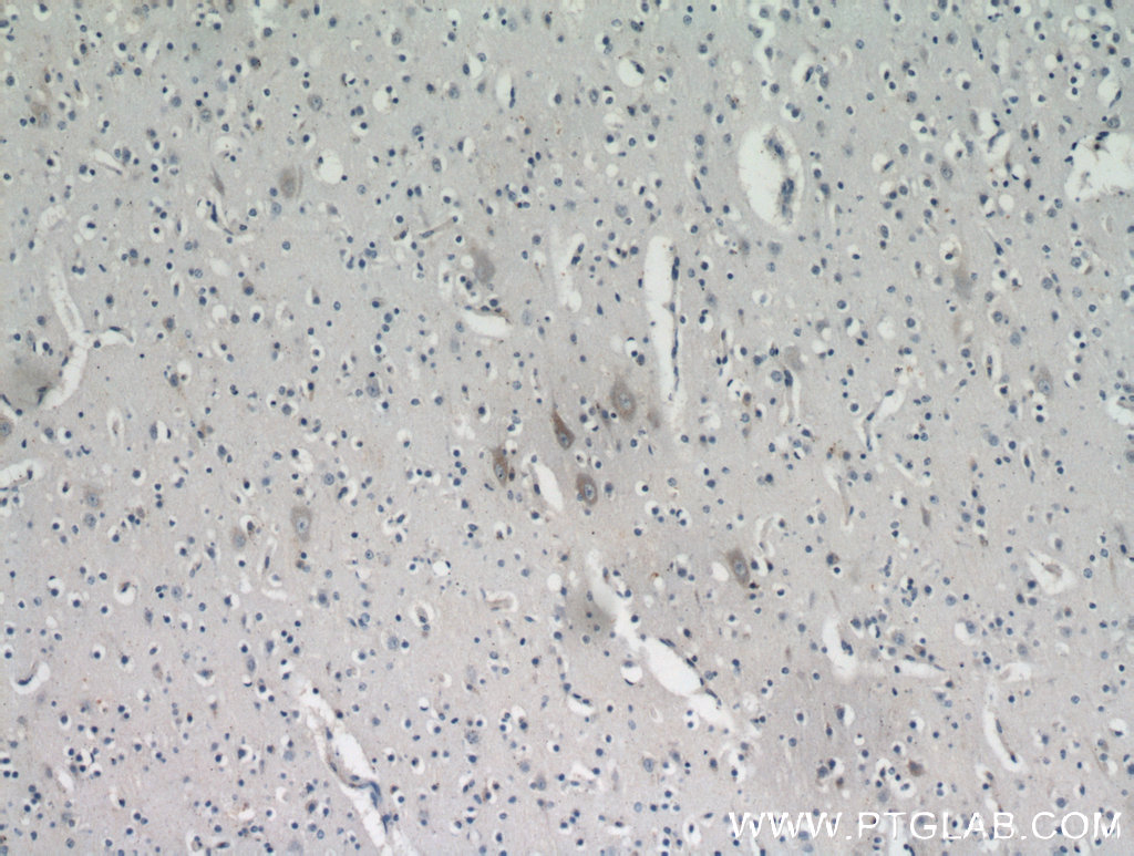 KIAA0319L Polyclonal antibody