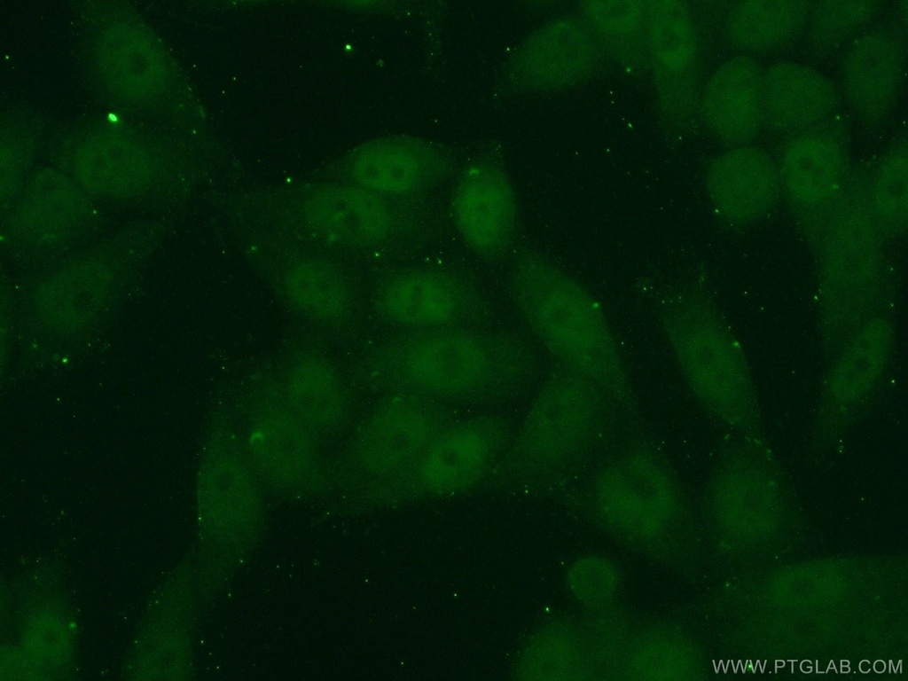 KLF5 Polyclonal antibody