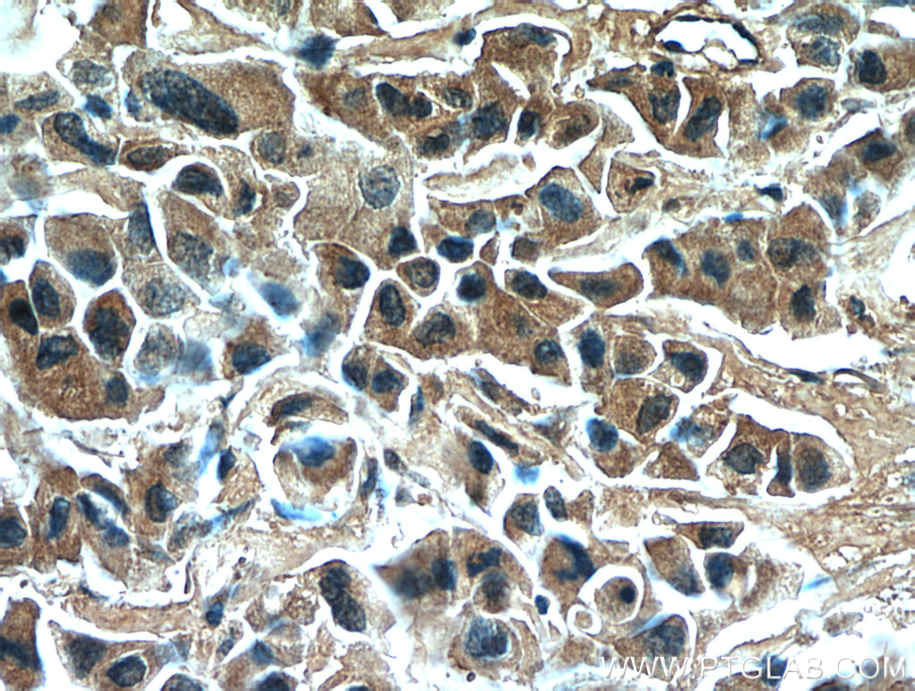 RNF170 Polyclonal antibody