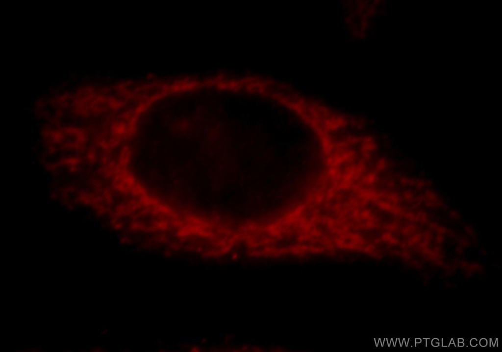 TRIM46 Polyclonal antibody