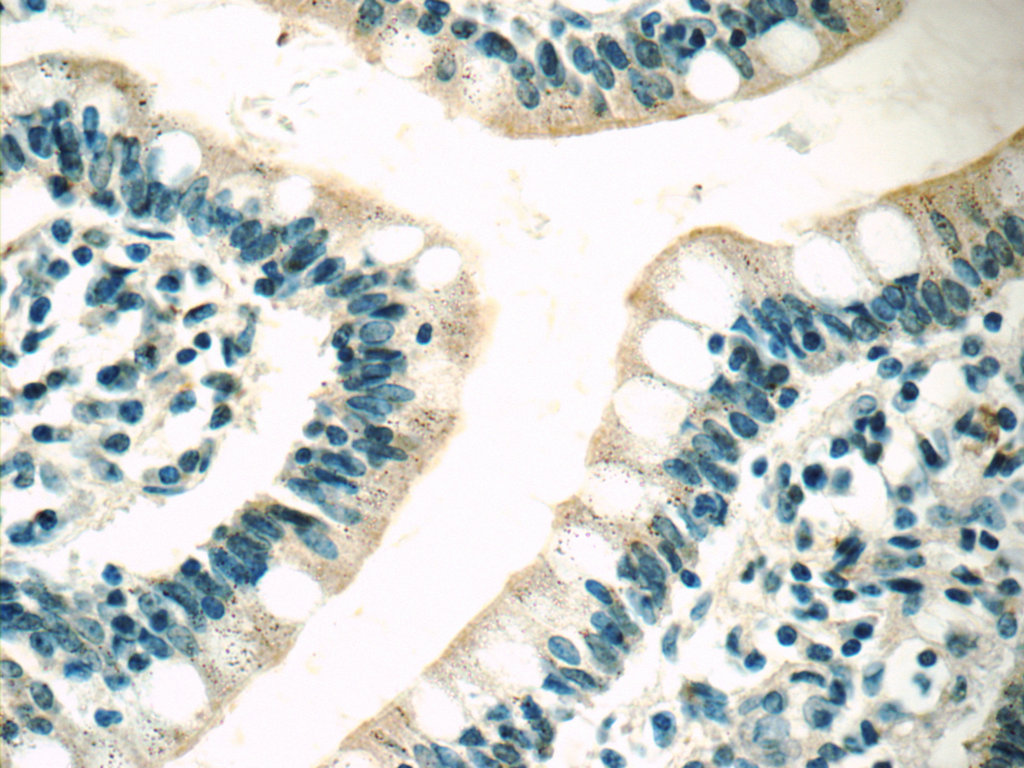 MC3R Polyclonal antibody