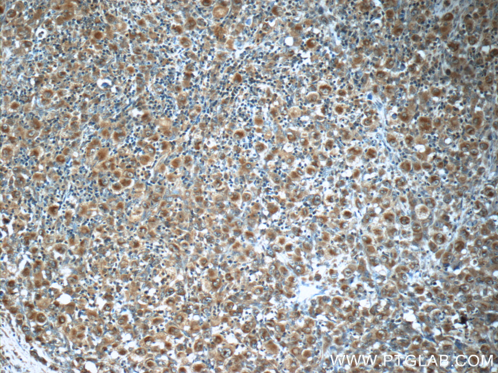 RNF213 Polyclonal antibody