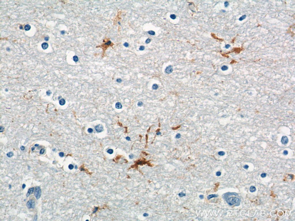 MAS1L Polyclonal antibody