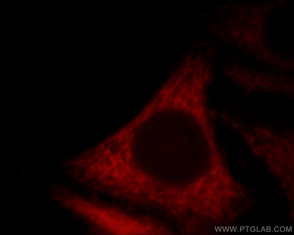 FSD1L Polyclonal antibody
