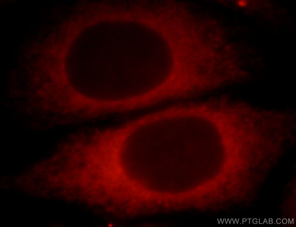 UBXD2 Polyclonal antibody