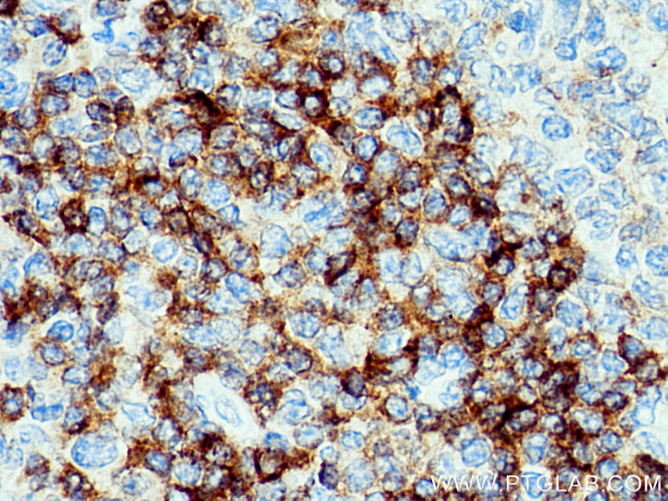 CD79B Polyclonal antibody