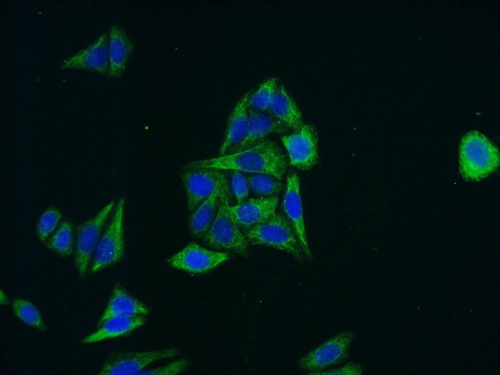 MLKL Polyclonal antibody