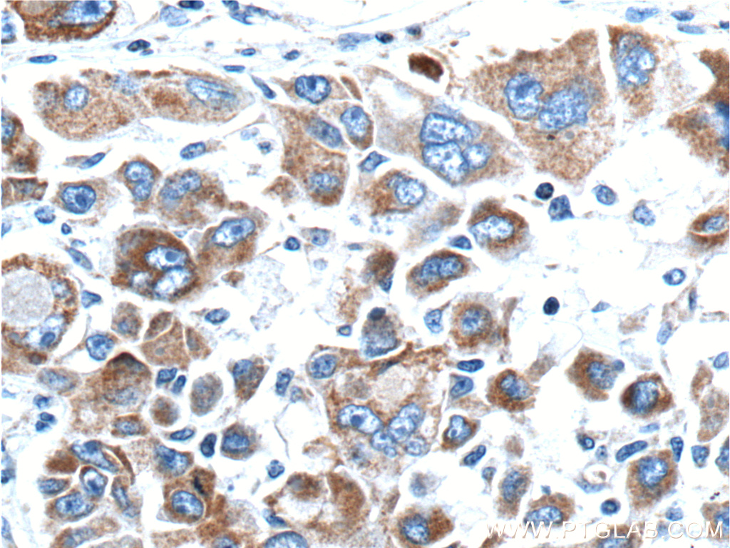 MEKK3 Polyclonal antibody