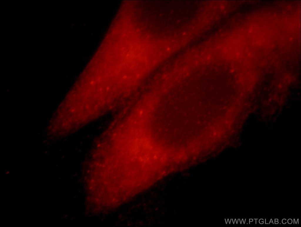 TRIM54 Polyclonal antibody