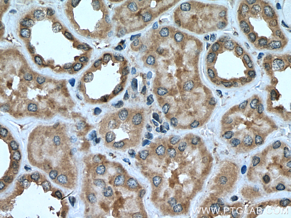 CCDC50 Polyclonal antibody