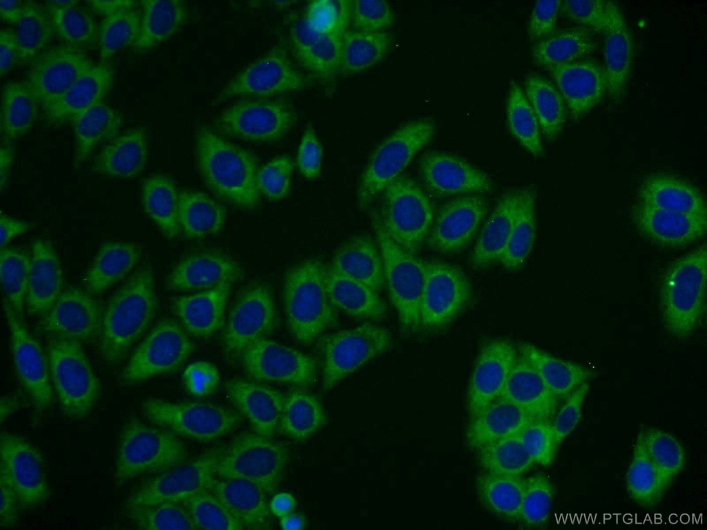 TBC1D19 Polyclonal antibody