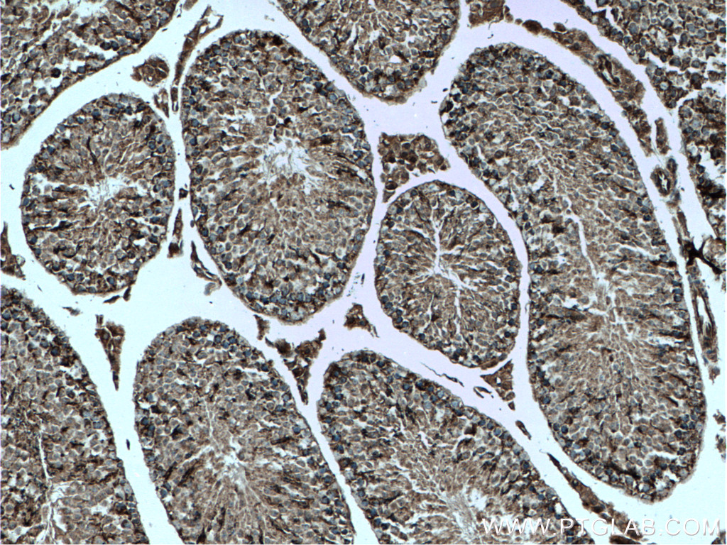 CHCHD4 Polyclonal antibody