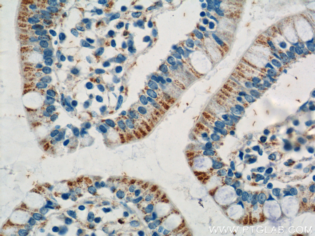 ANKRD13D Polyclonal antibody