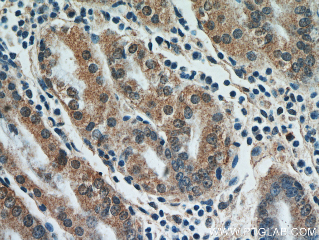 FAM101A Polyclonal antibody