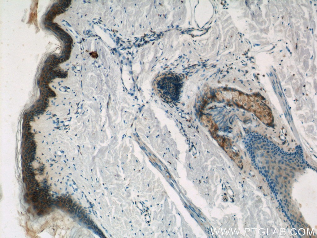 PGLYRP4 Polyclonal antibody